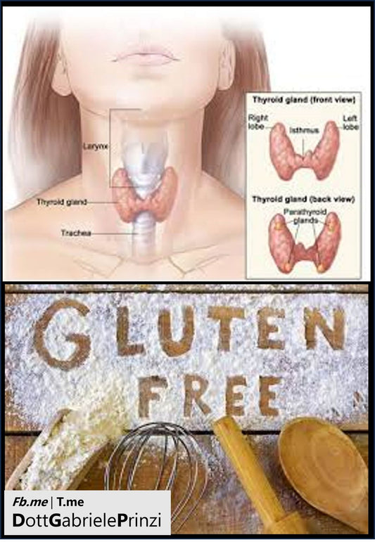 Effetto della Dieta Senza Glutine sulla Progressione della Tiroidite di Hashimoto