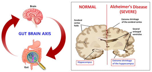 Alzheimer e Disbiosi: La Relazione tra Microbiota Intestinale e Alzheimer Dimostrata per la Prima Volta in Laboratorio (Asse Intestino-Cervello)